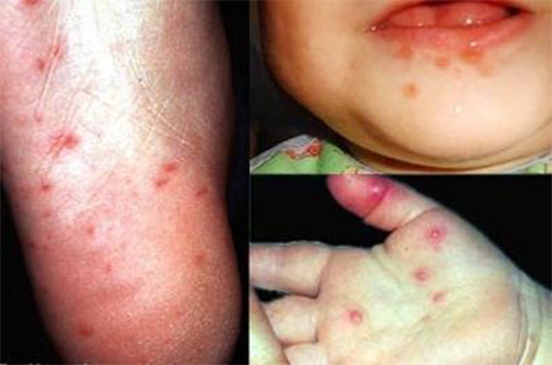 рука нога рот