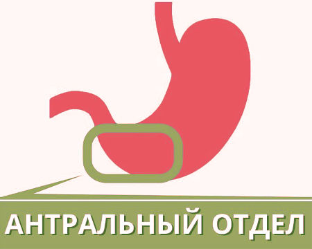 Гастрит антрального отдела желудка Антральный отдел желудка